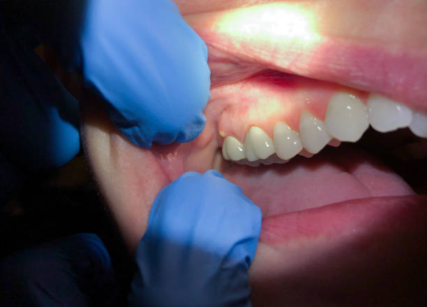 Best Dentist for Severe Toothache  in Crown Pot, IN