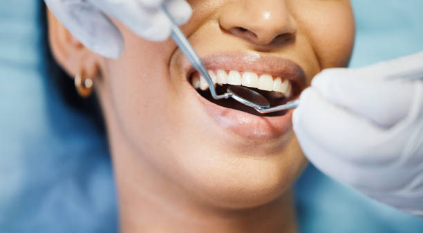 Best Urgent Tooth Repair  in Crown Pot, IN