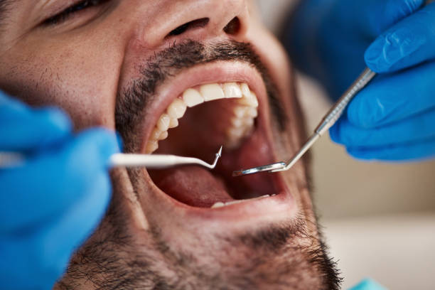 Best Affordable Emergency Dental Care  in Crown Pot, IN
