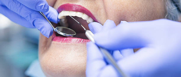 Best Broken Tooth Emergency  in Crown Pot, IN